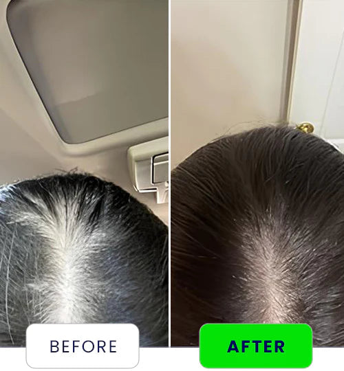 HAIR SERUMS